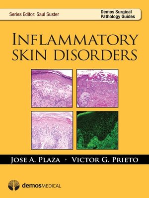 cover image of Inflammatory Skin Disorders